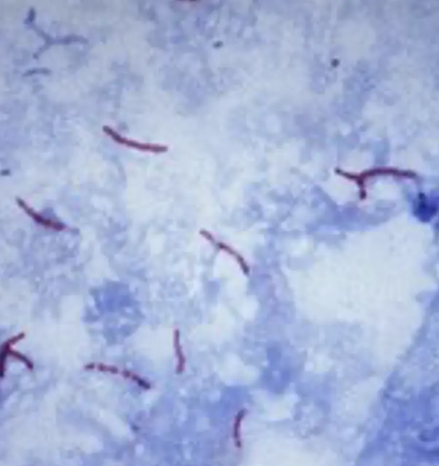 Fushine, pas si basique que &ccedil;a !