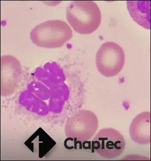 Les colorations hématologiques et l'effet Romanovsky