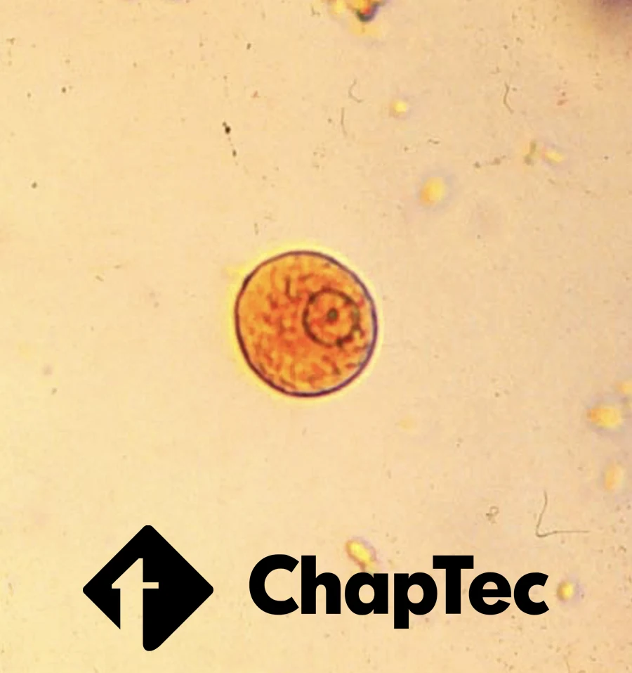 Joies et défis de la parasitologie