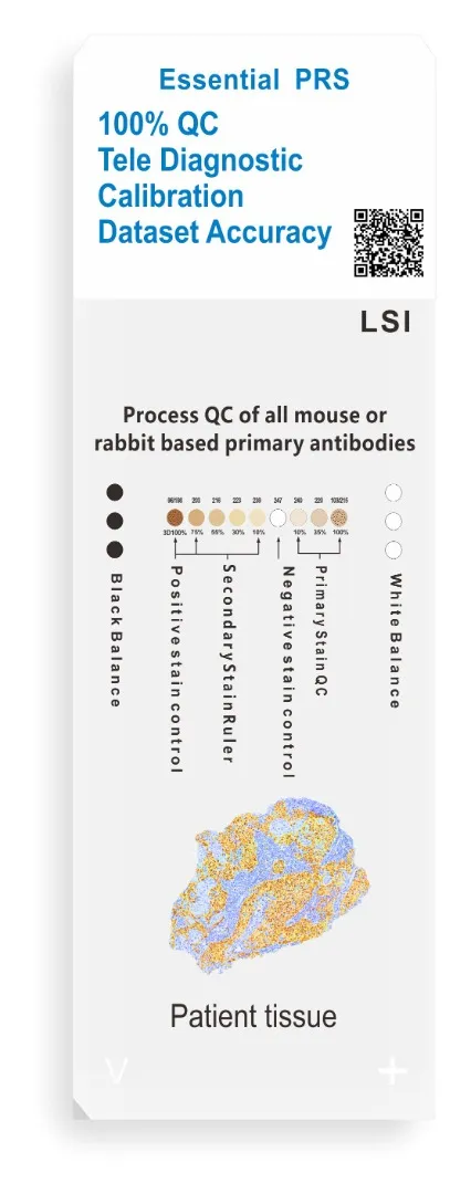 PRS Lame contrôle pour immunohistochimie